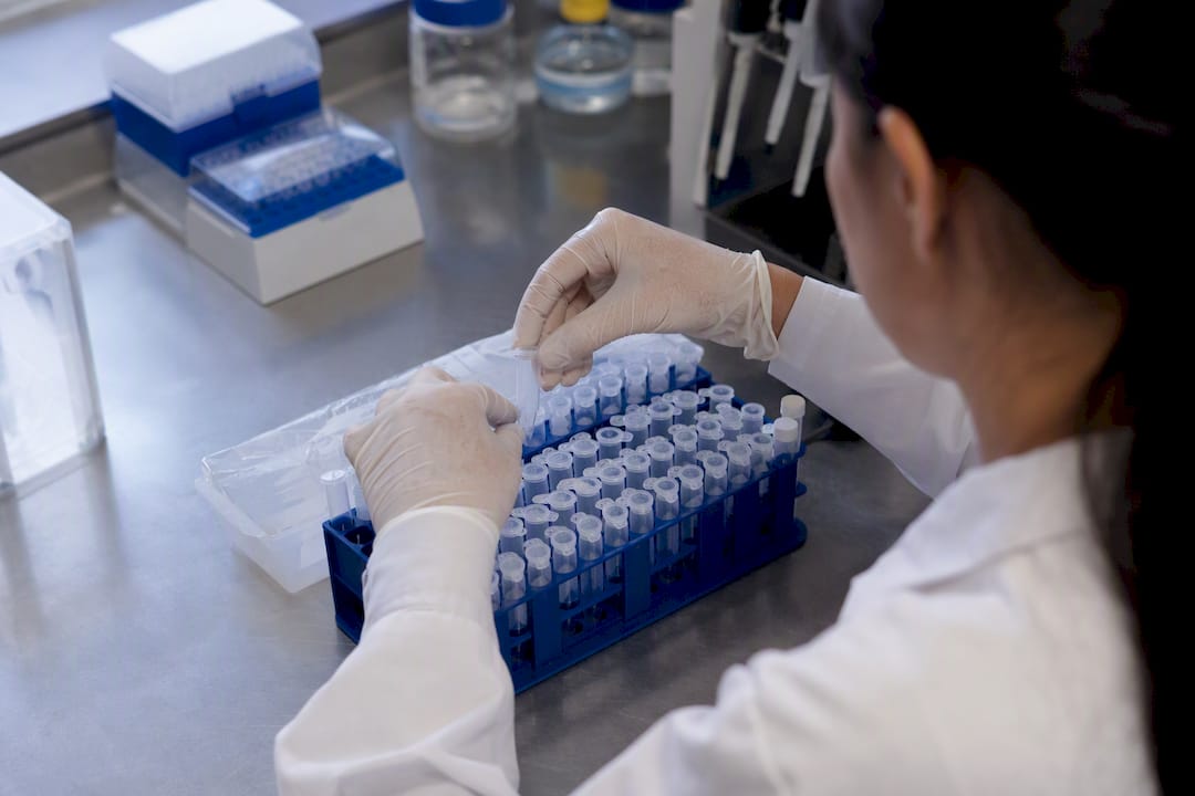 Hands loading glucose assay samples in lab